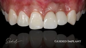 Digital dentistry in Banani, Gulshan