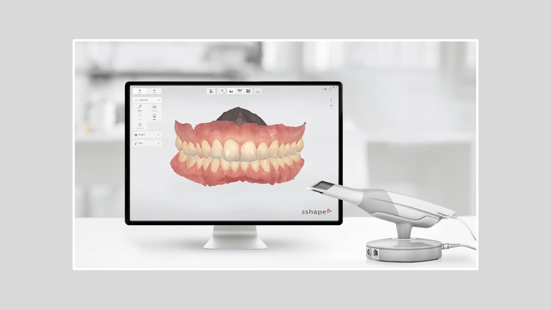 3D Intraoral Scanner