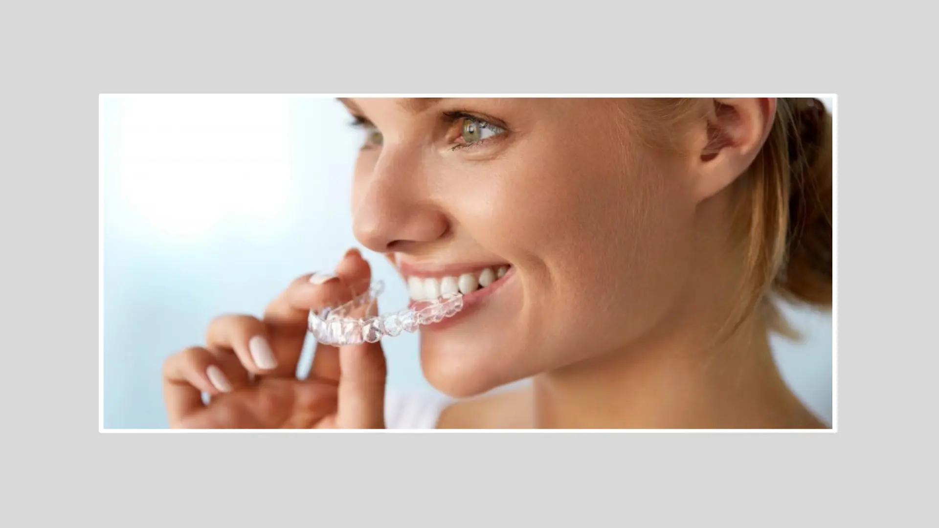 Invisalign Clear Aligner