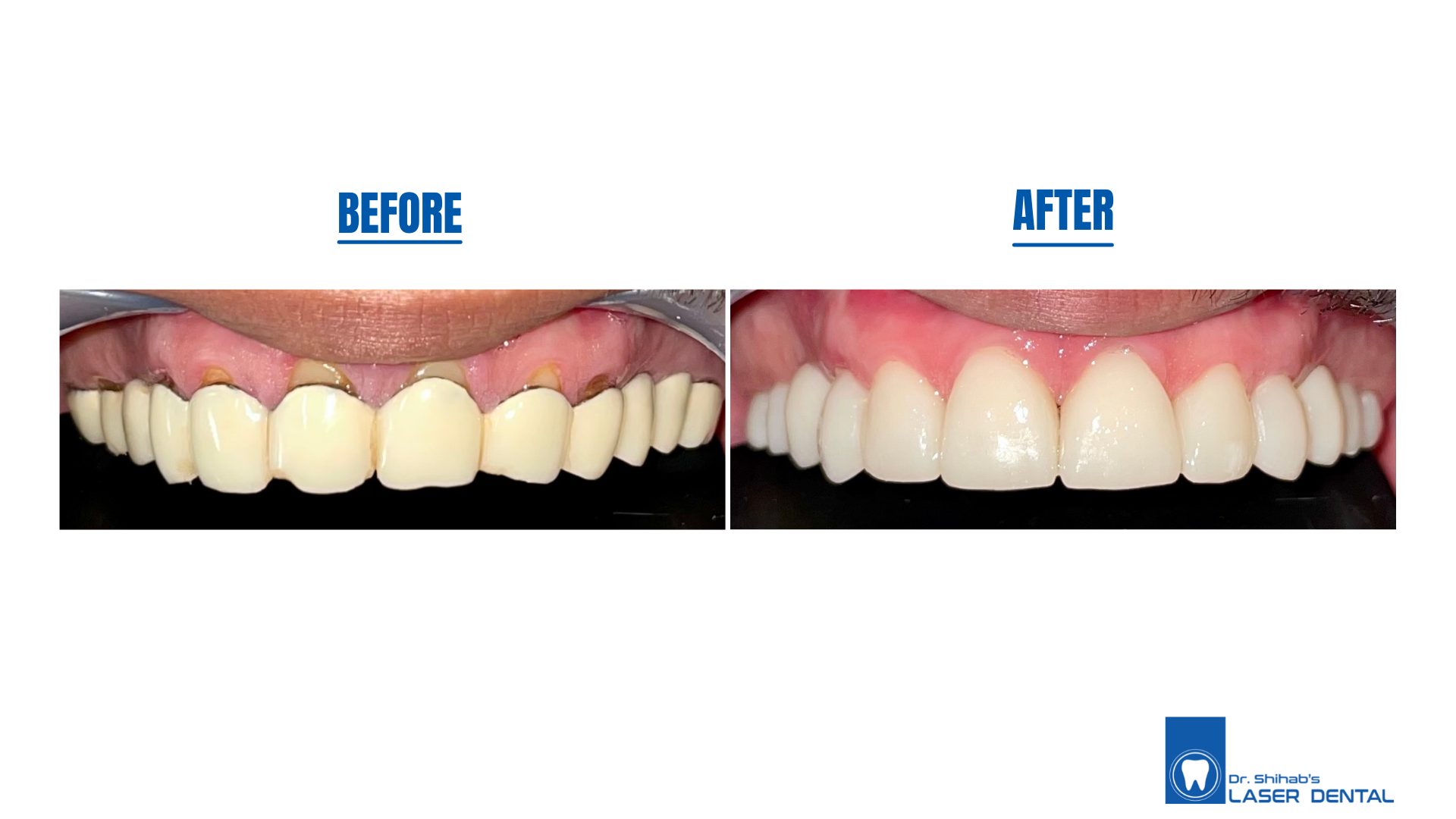 Digital Smile Design