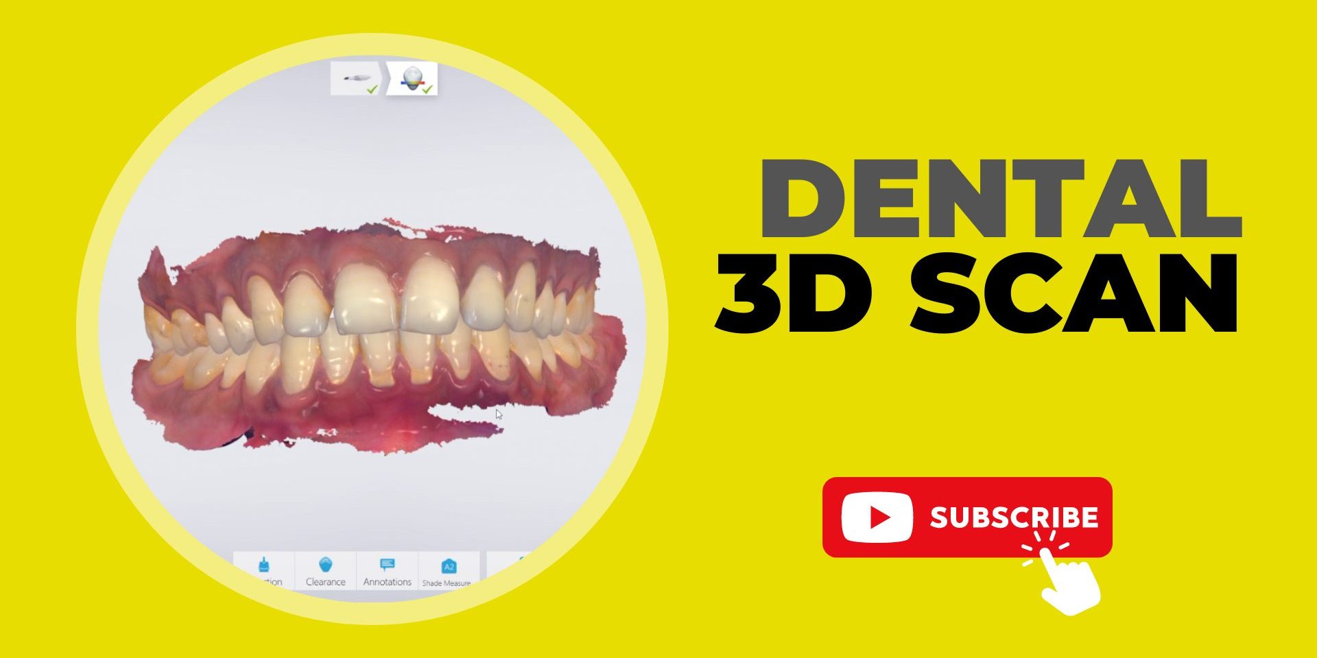 3D Dental Scan A New Era in Digital Dentistry LASER DENTAL