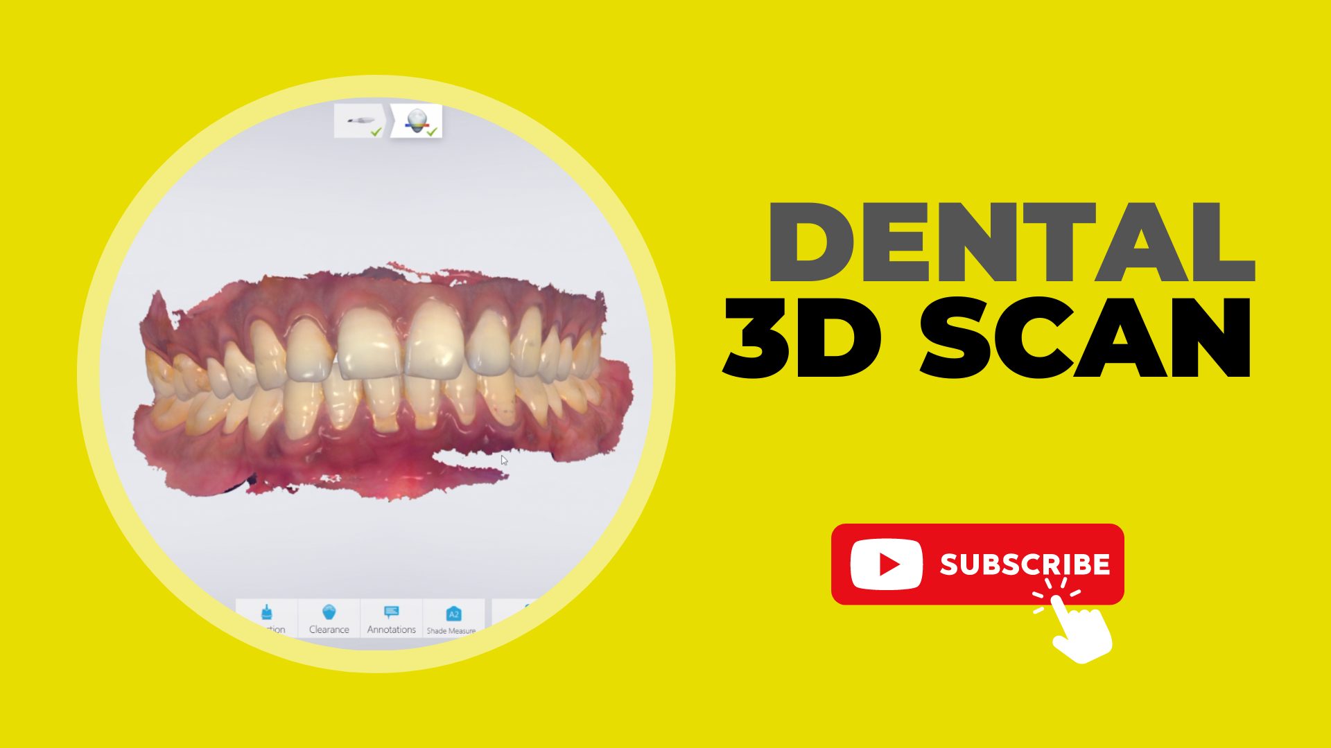 3D Dental Scan A New Era in Digital Dentistry LASER DENTAL